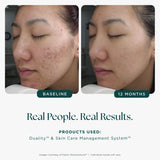 Jan Marini Age Intervention Duality 1 oz