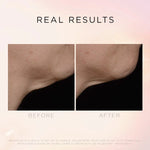 Cosmedix Illuminate and Lift Neck & Décolleté Treatment 2.6 oz